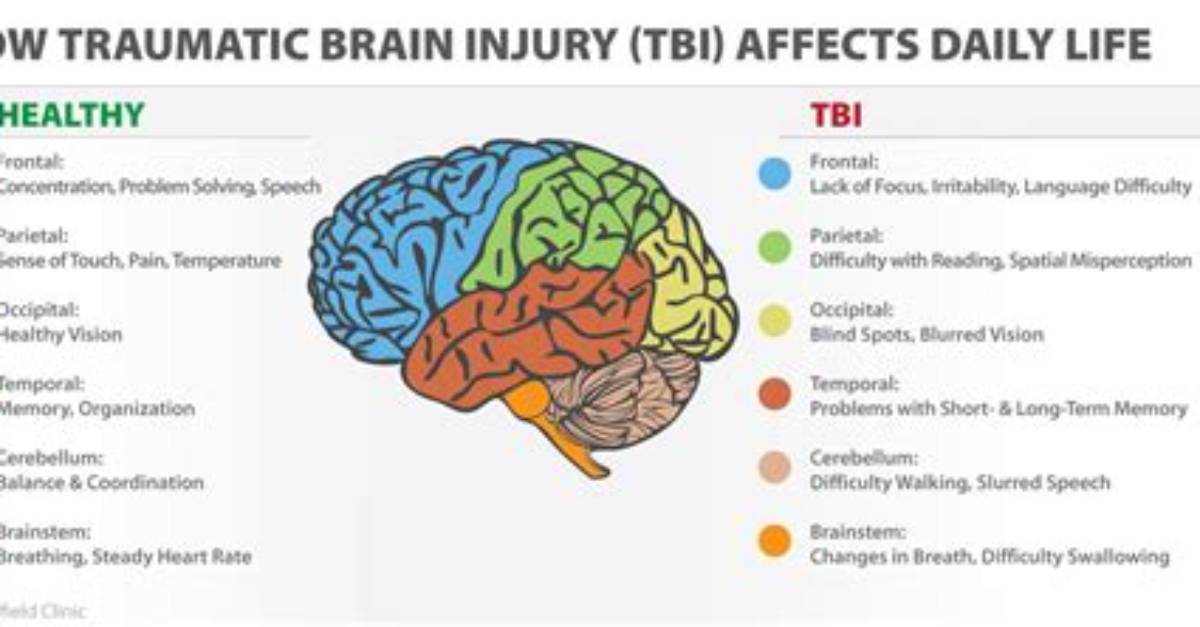 How Does a Tbi Work