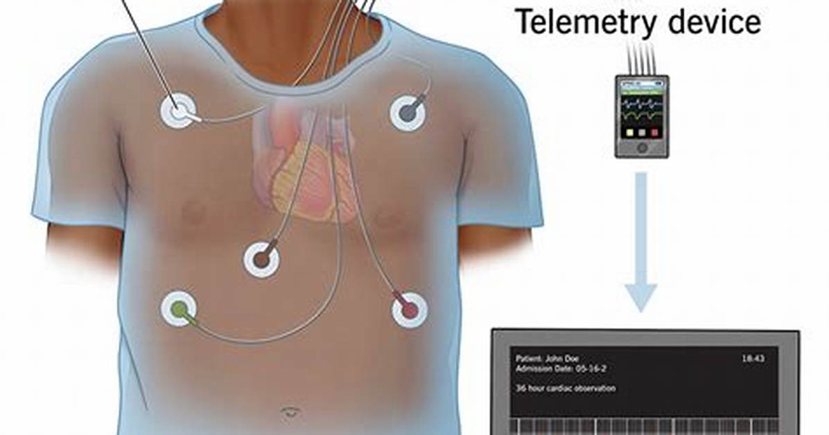 How Does a Telemetry Work?
