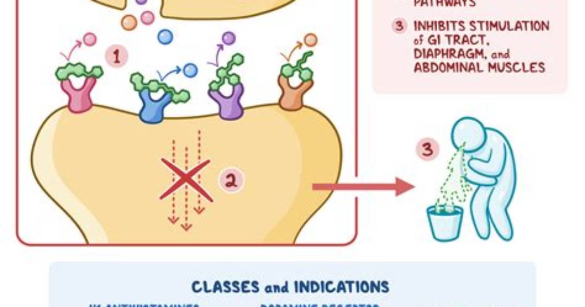 How Does an Antiemetic Work?