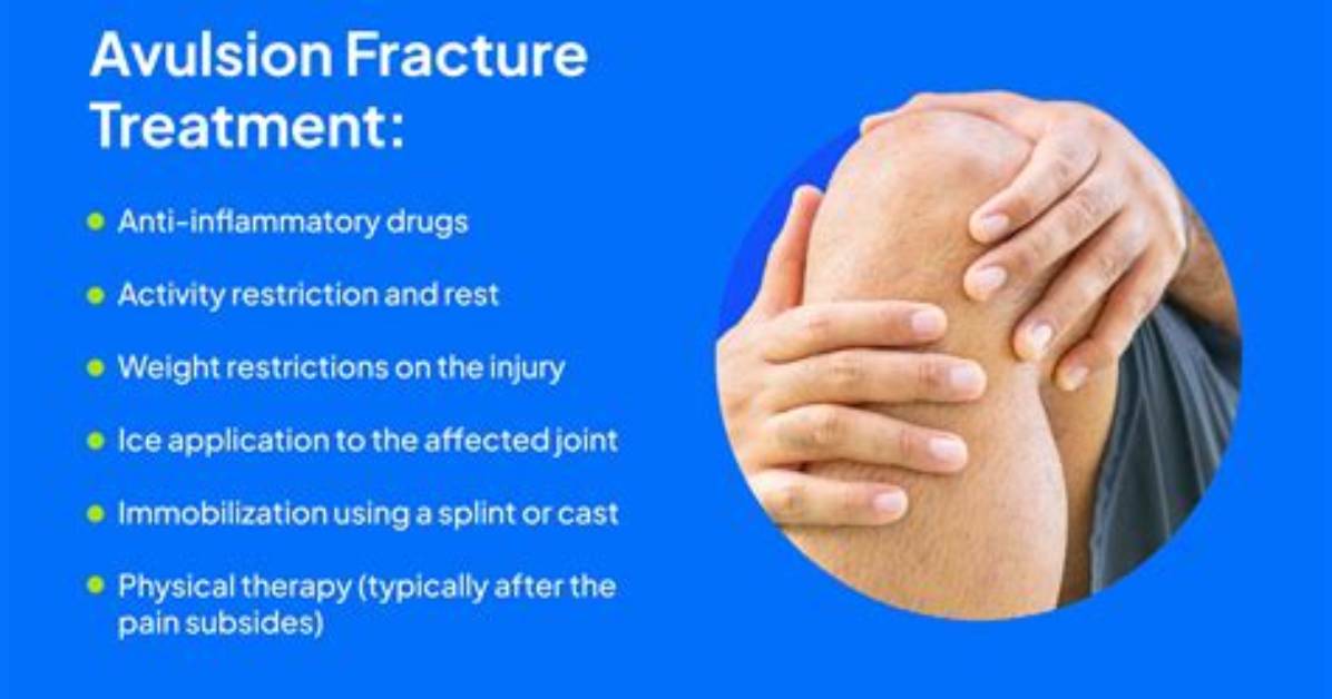 How Does an Avulsion Heal