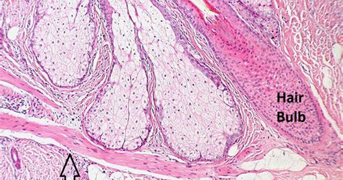 How Does Arrector Pili Occur?