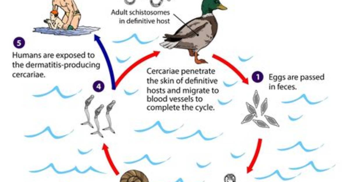 How Does Cercarial Dermatitis Spread?