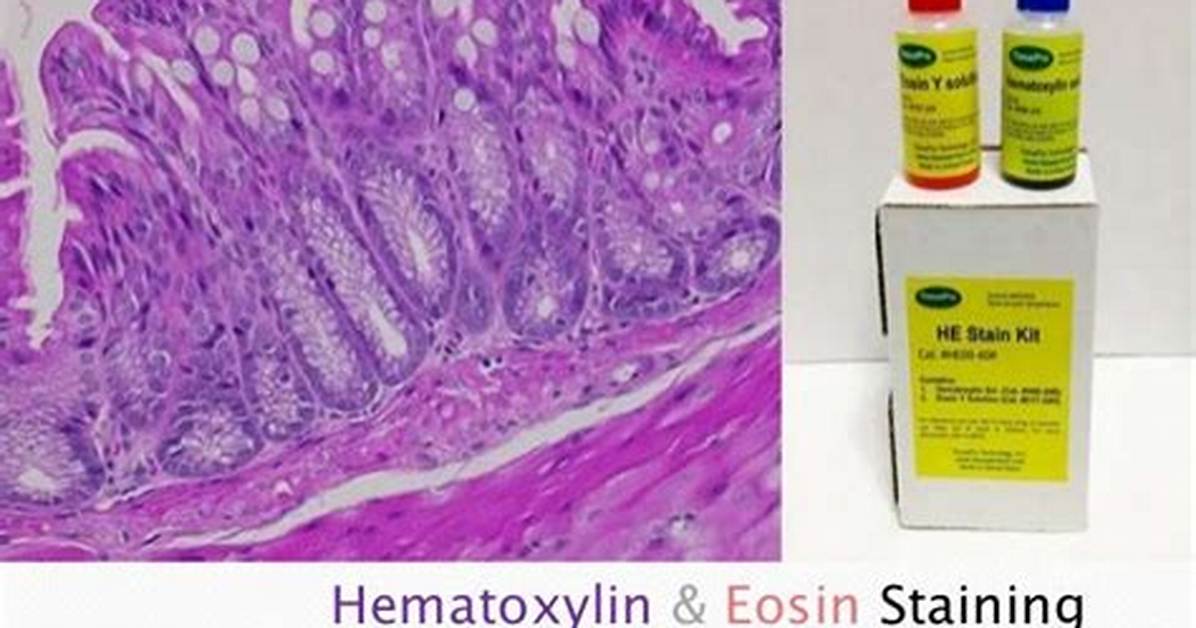 How Does Hematoxylin and Eosin Staining Work