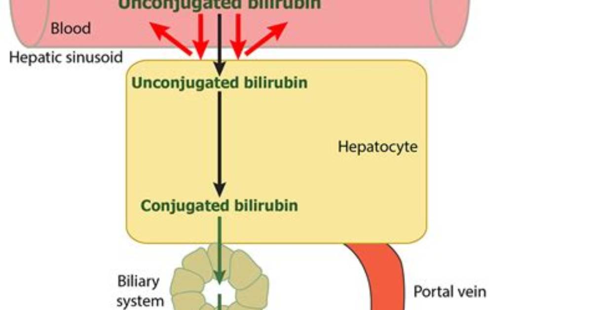 How Does Hemolysis Affect Bilirubin?