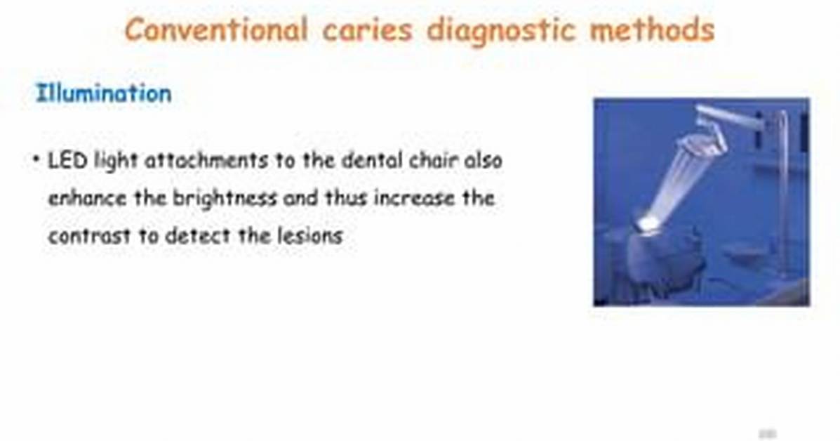 How Does Light Illumination Detect Caries