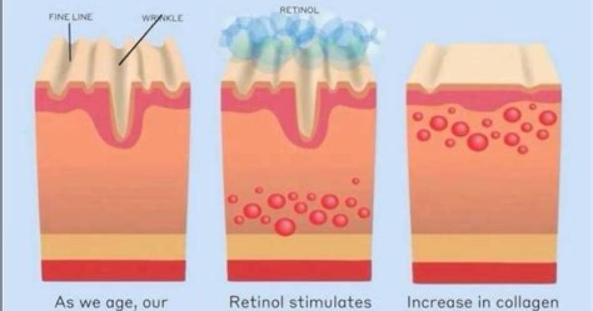 How Does Retinol Work - How to Discuss