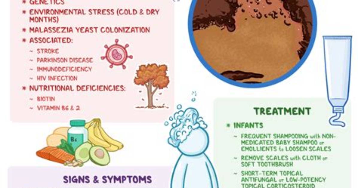 How Does Seborrhea Develop?
