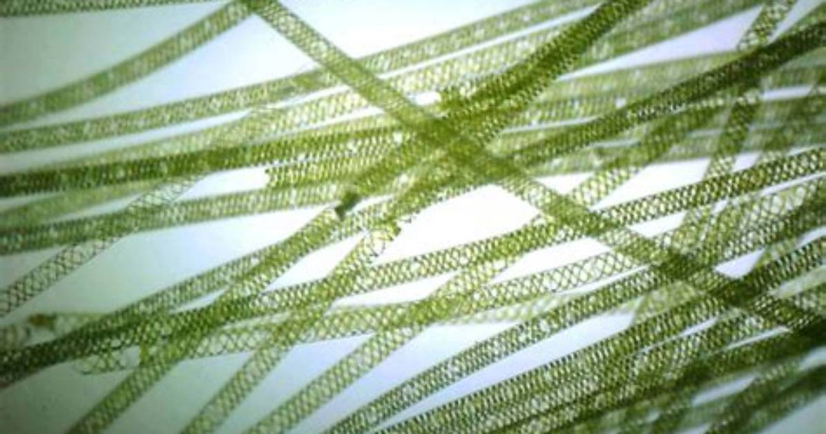 How Does Spirogyra Look Like