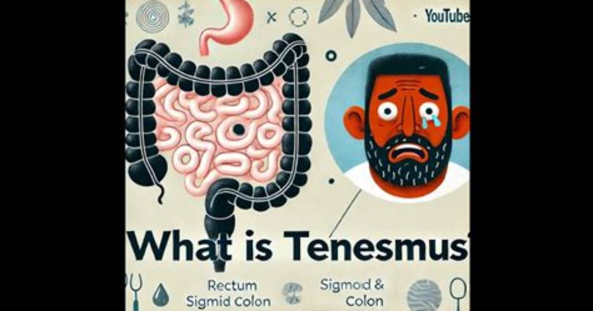 How Does Tenesmus Work?