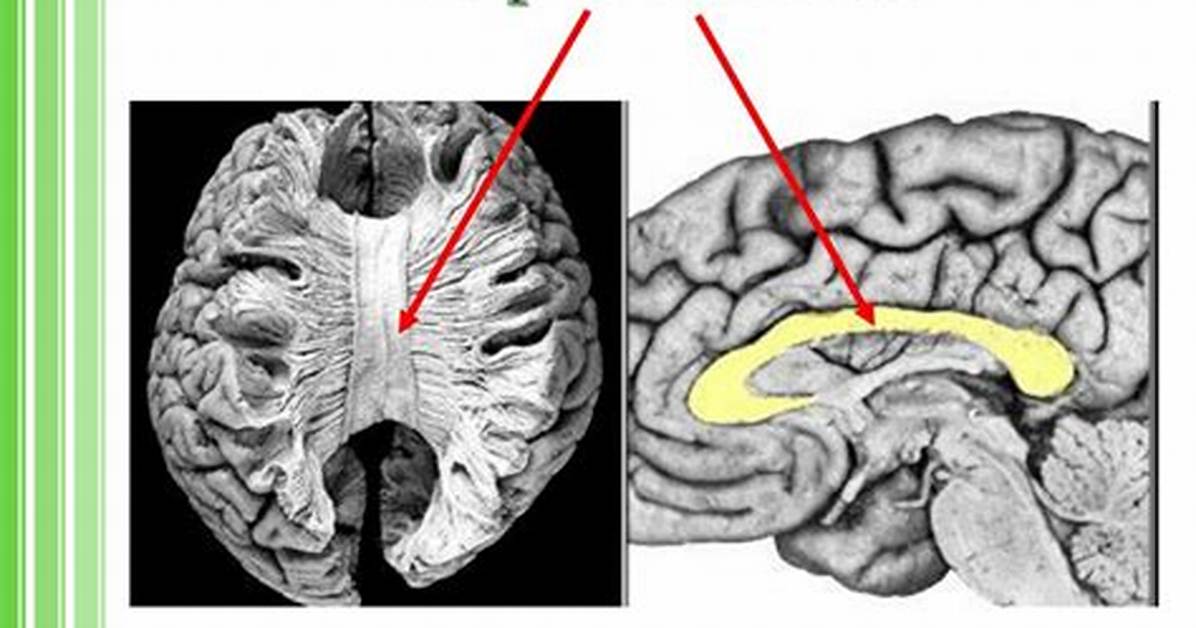 How Does the Corpus Callosum Develop?