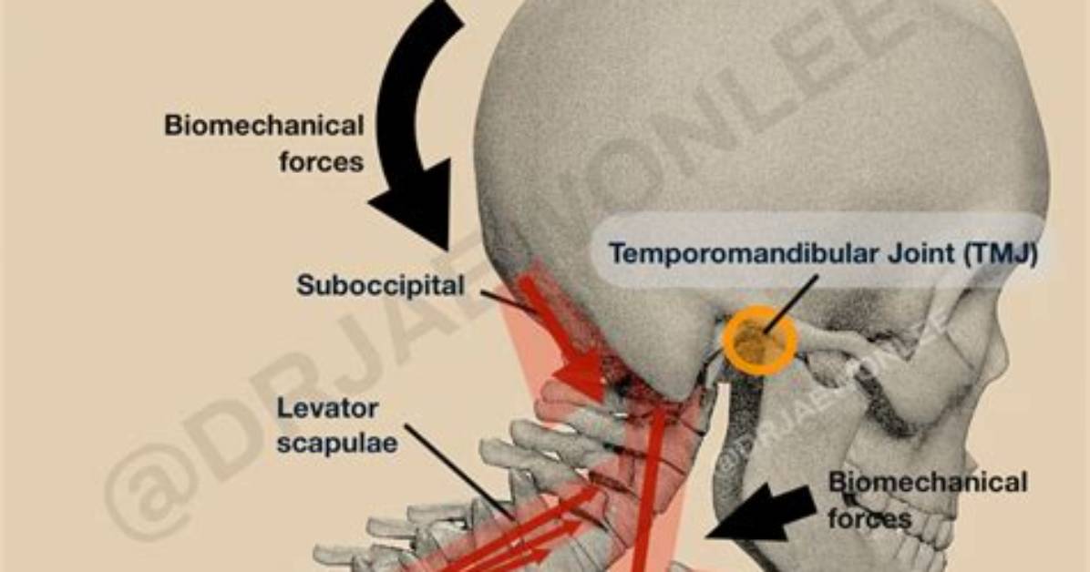 How Does Tmj Affect Posture