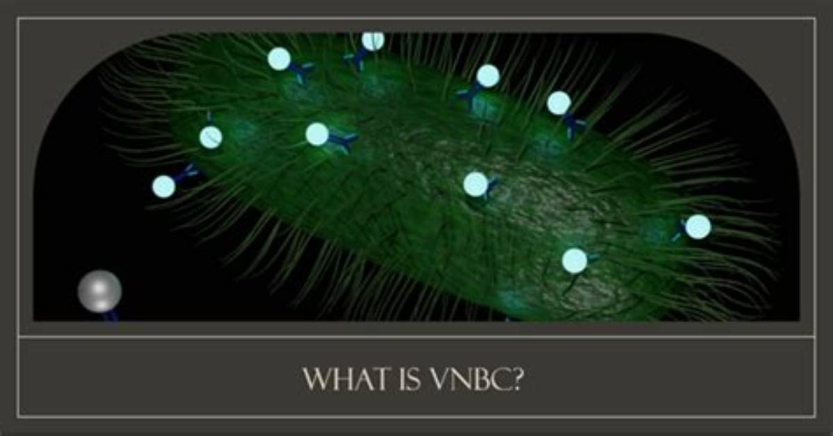 How Does Vbnc Detect