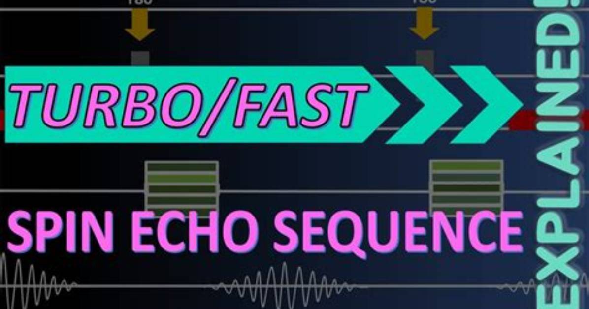 How Fast Do Turbos Spin