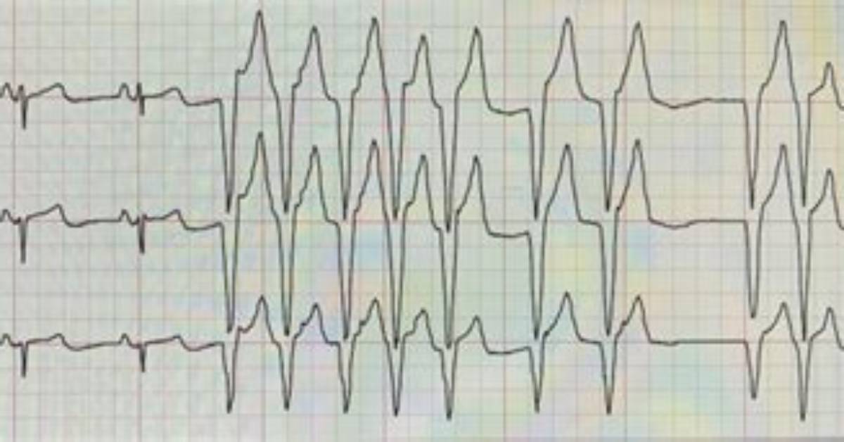 How Fast Is Aivr?