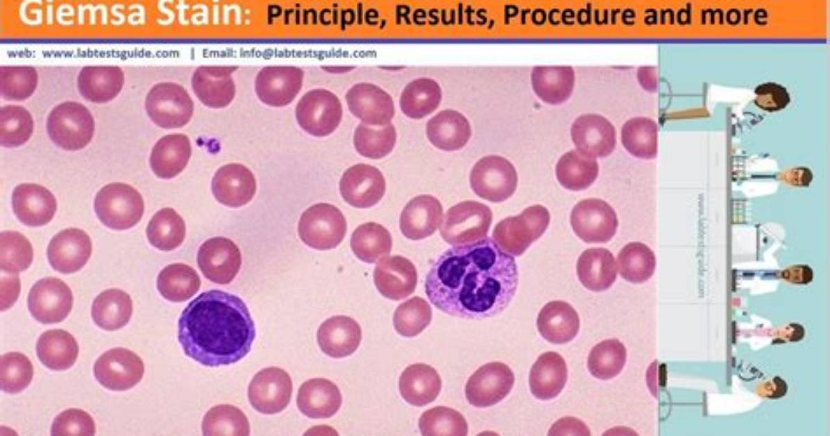 How Giemsa Stain Works?