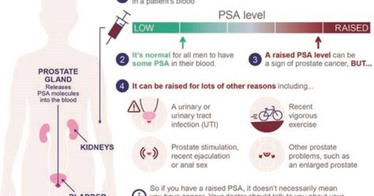How High Does Psa Have to Be Before Biopsy?