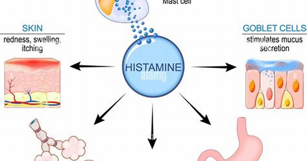 How Histamine Is Released?