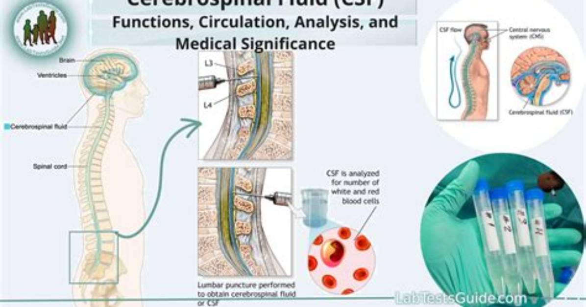 How Is Csf Fluid Produced