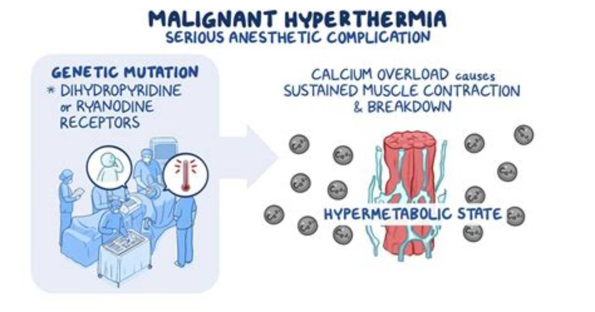 How Is Malignant Hyperthermia Detected