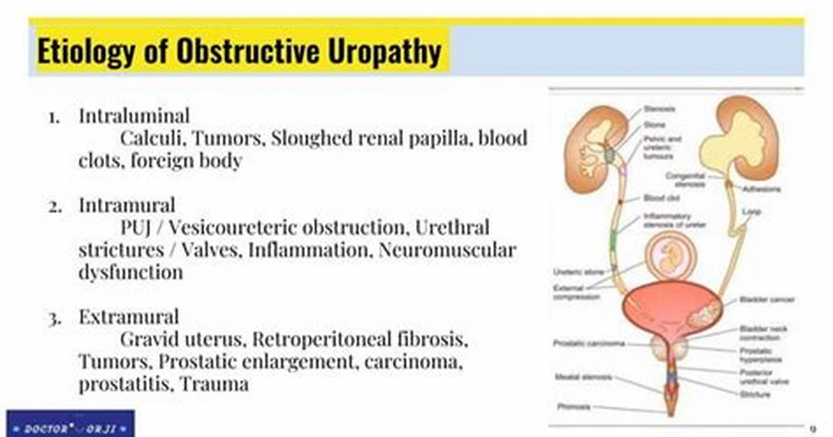 How Is Obstructive Uropathy Treated