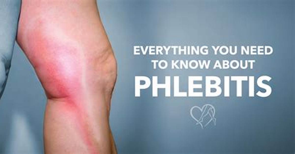 How Is Phlebitis Diagnosed