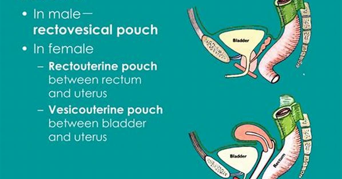 How Is Rectovesical Pouch Formed?