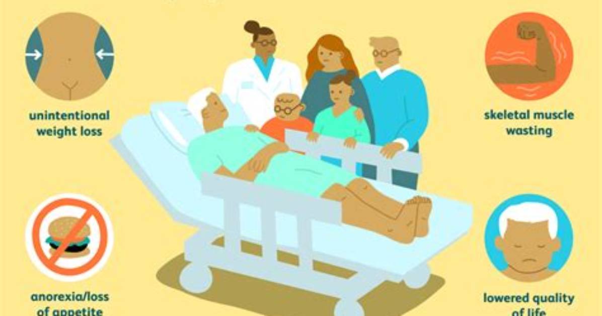 How Long Can You Survive with Cachexia