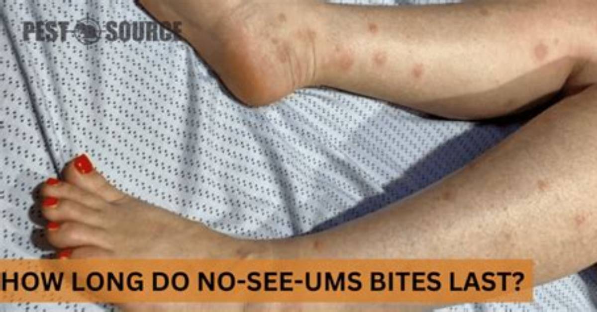 How Long Do No See Um Bites Last