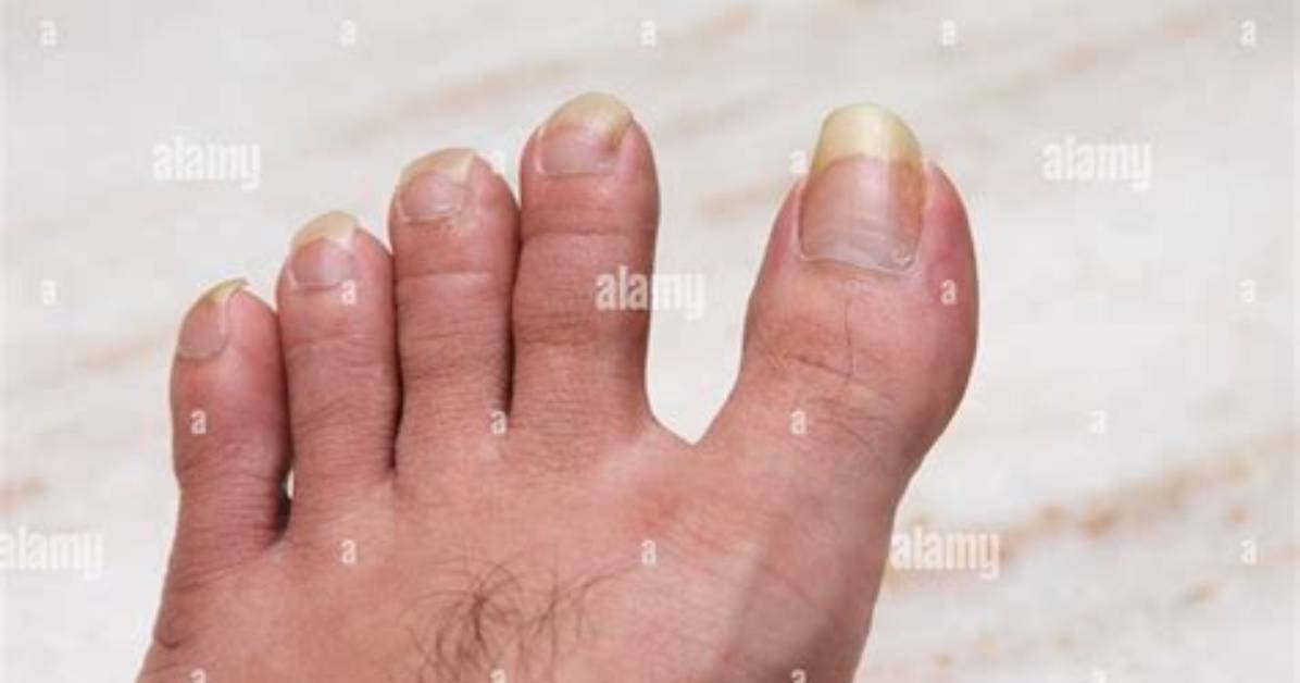 How Long Do Toe Nails Take