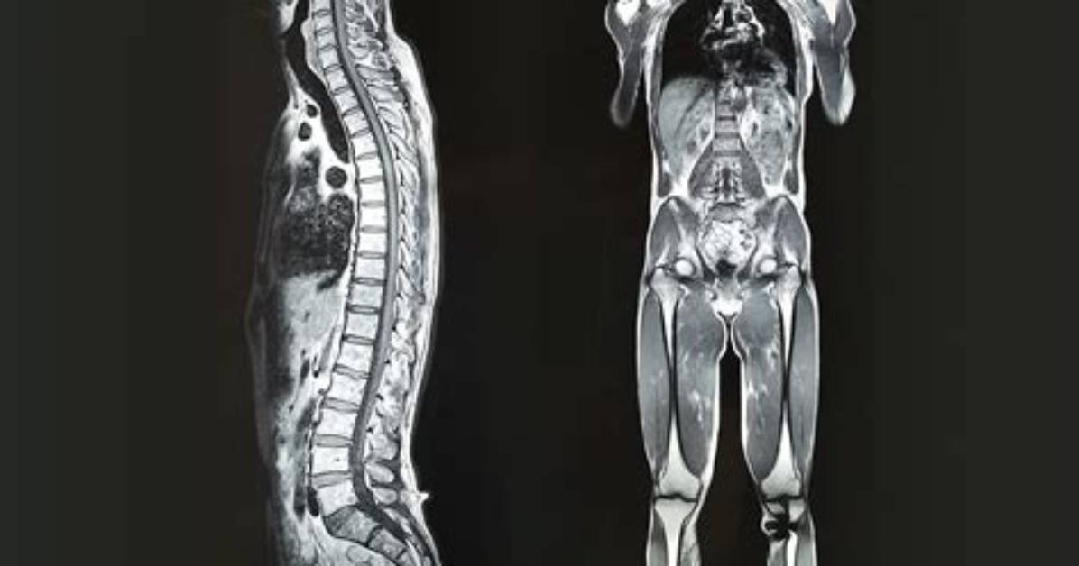 How Long Does a Full Body Mri Take?