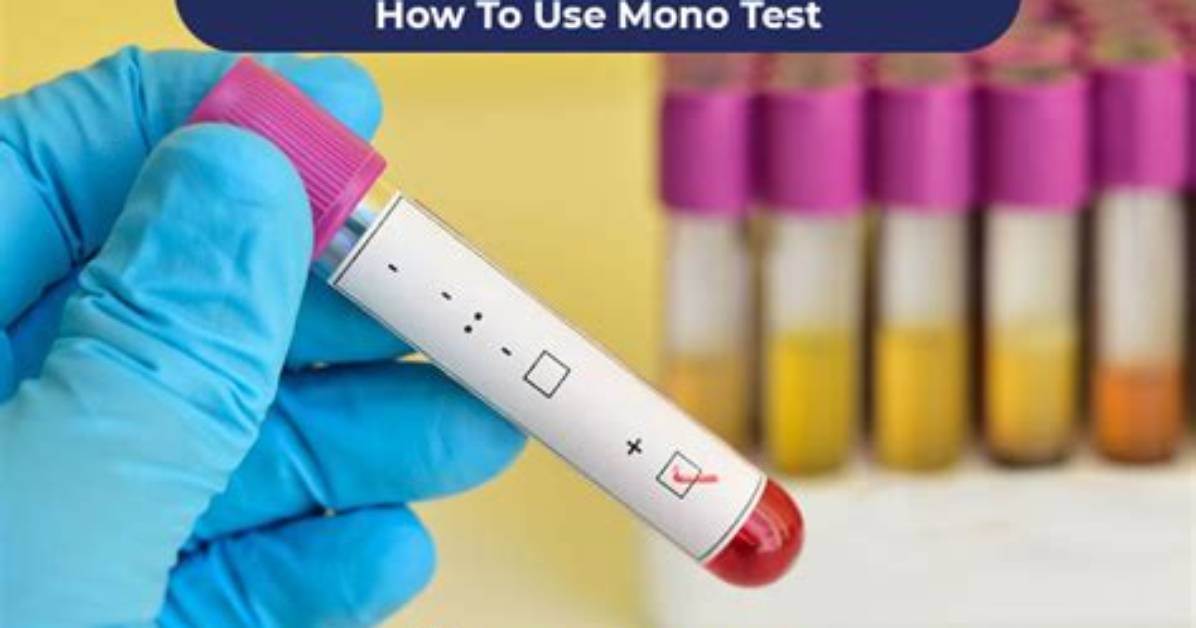 How Long Does a Mono Test Take to Process?
