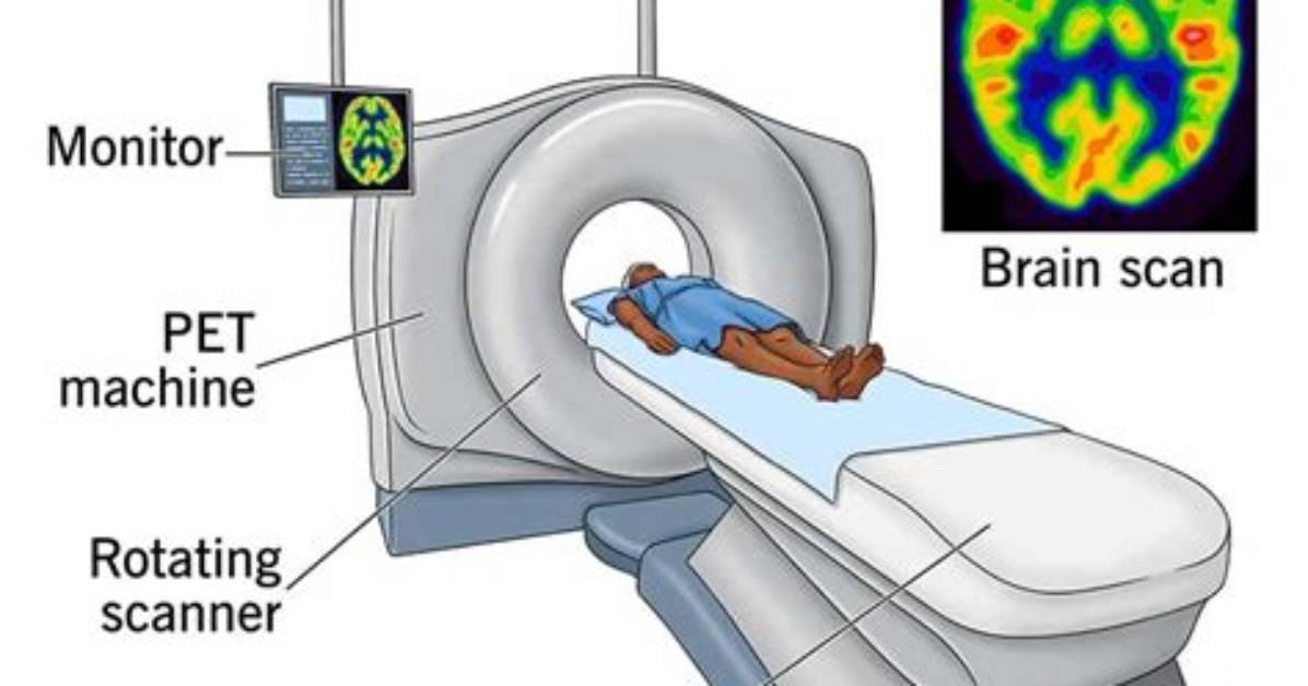 How Long Does a Pet Scan Take?