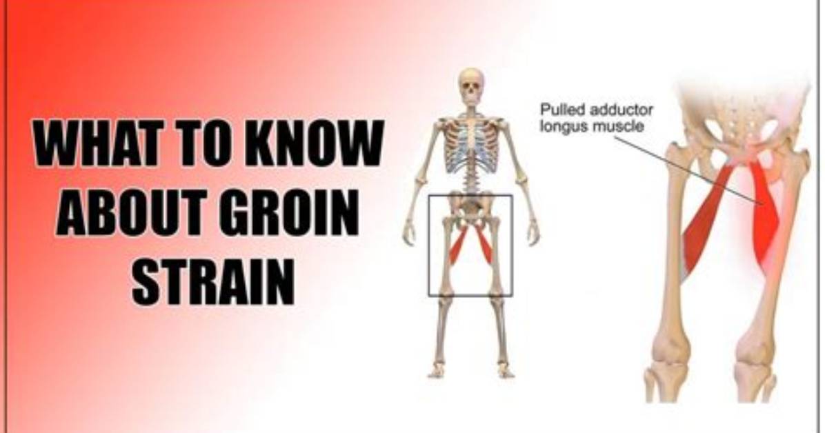 How Long Does a Pulled Groin Take to Heal?