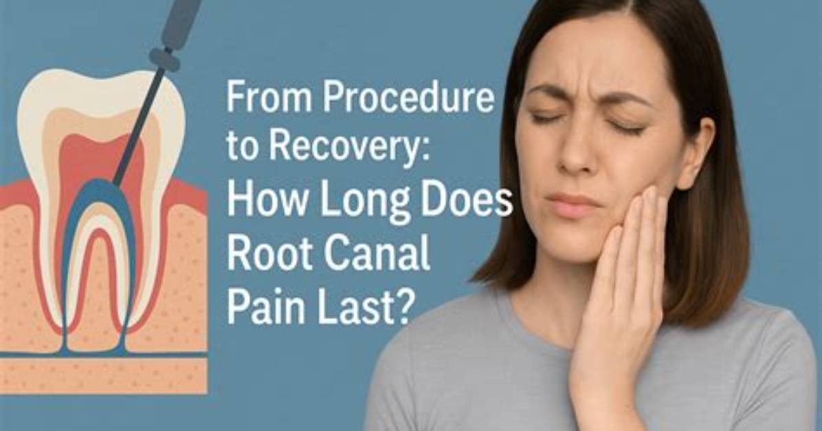 How Long Does a Root Canal Last?