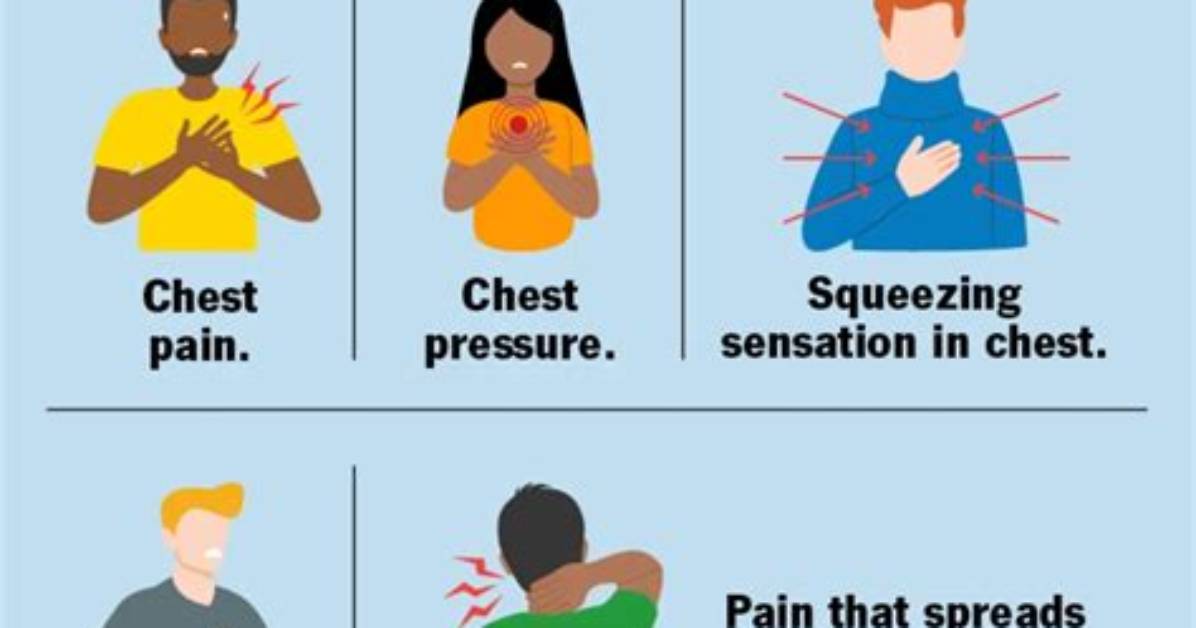 How Long Does Angina Last?