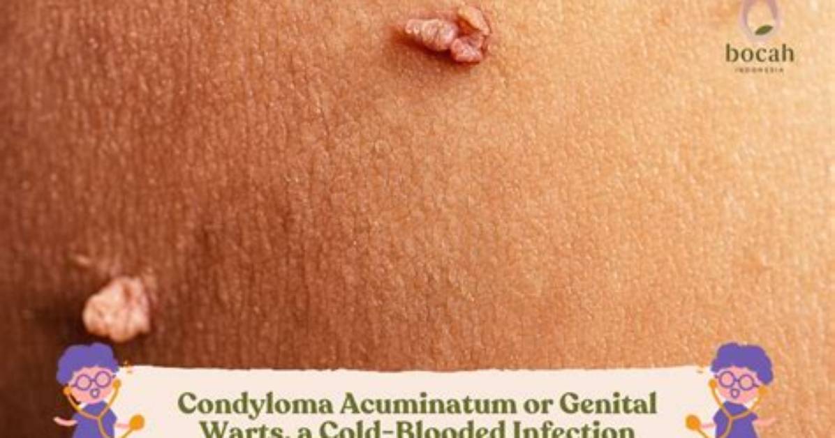 How Long Does Condyloma Last