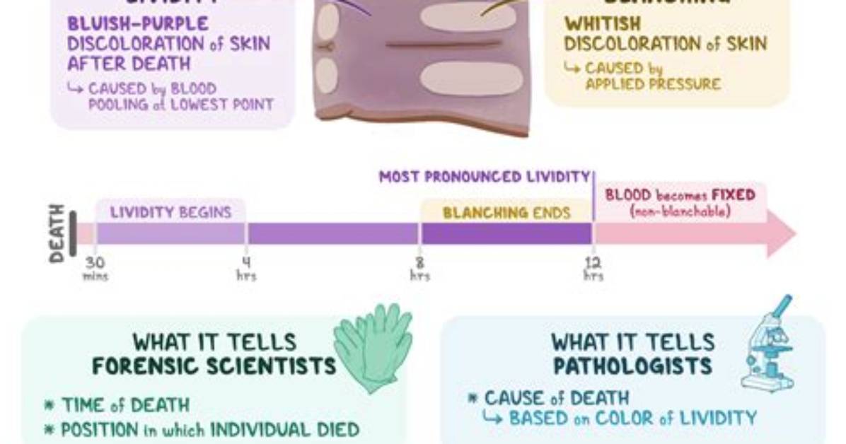 How Long Does Dependent Lividity Take?