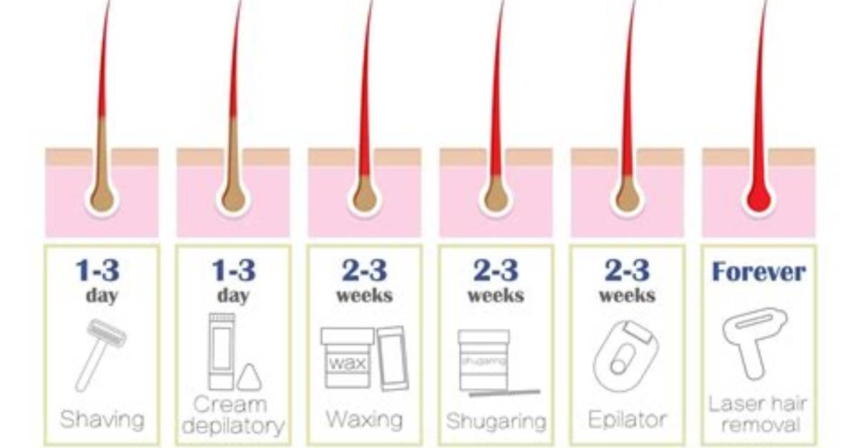 How Long Does Epilating Legs Last?