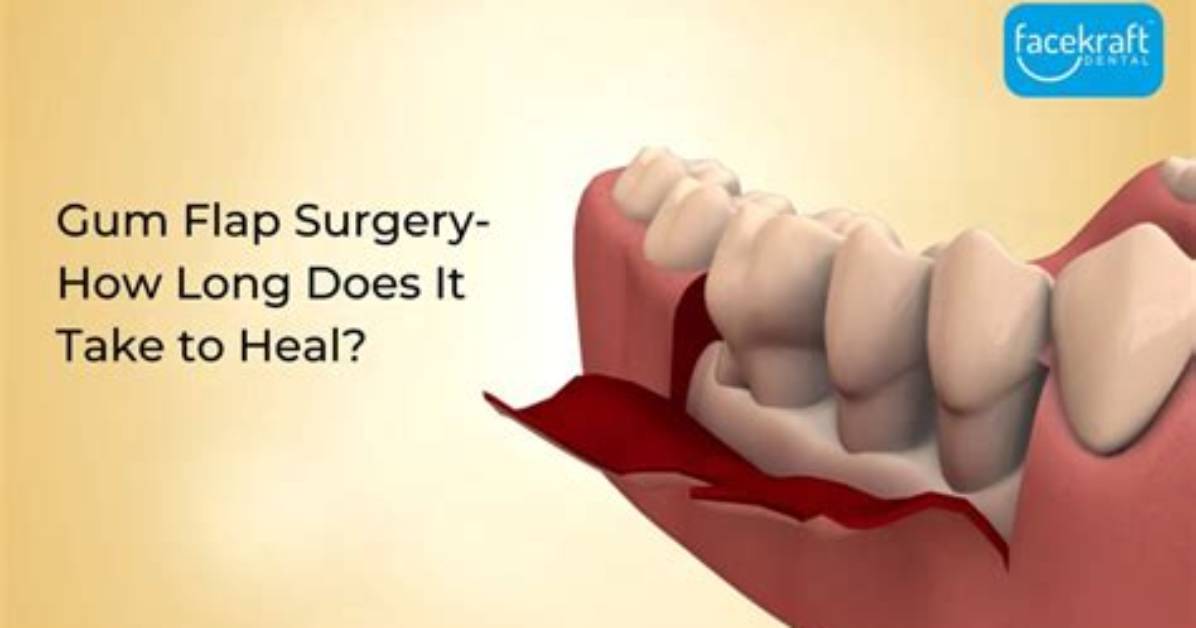 How Long Does Gum Surgery Take?