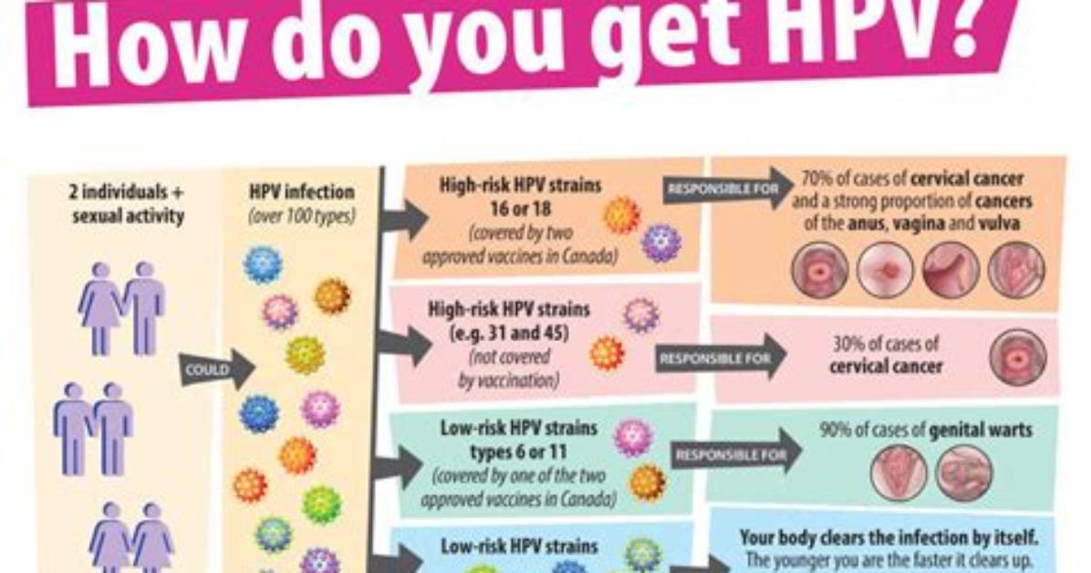 How Long Does High Risk Hpv Last?