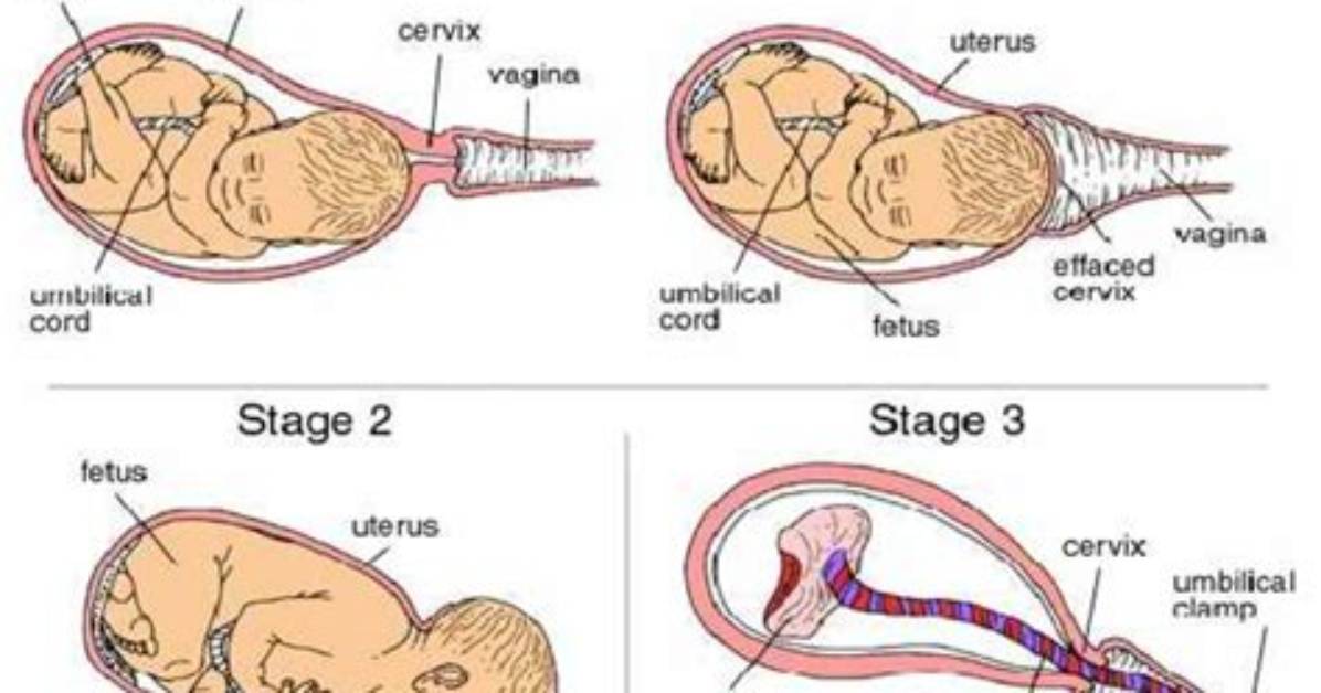 How Long Is Stage 2 Labor