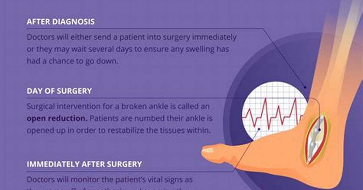 How Long Limping After Broken Ankle?