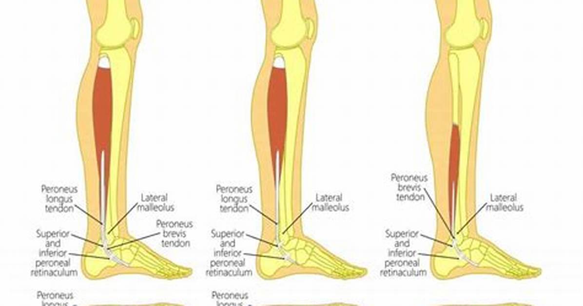 How Long Peroneal Tendon Surgery?