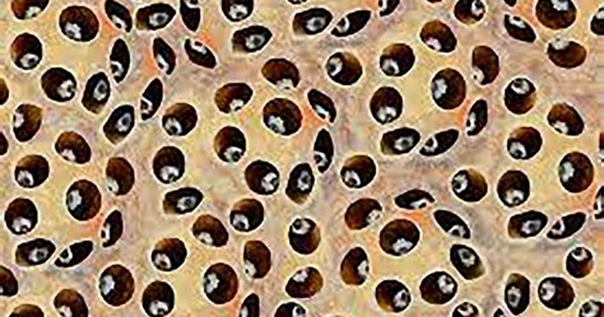 How Many Have Trypophobia