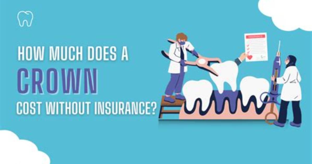 How Much Does Crown Cost Without Insurance?