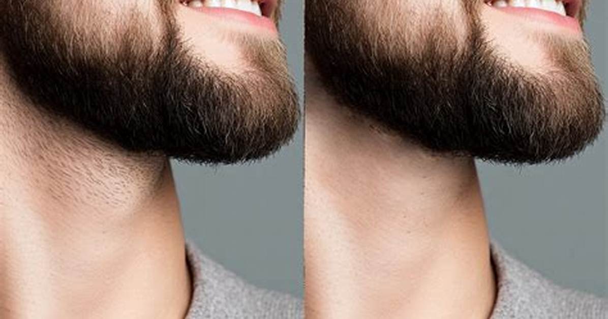 How Much Is a Beard Shave