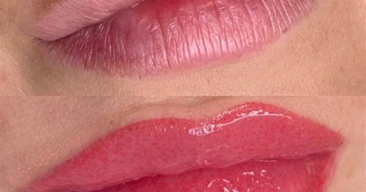 How Much Is Lip Blushing