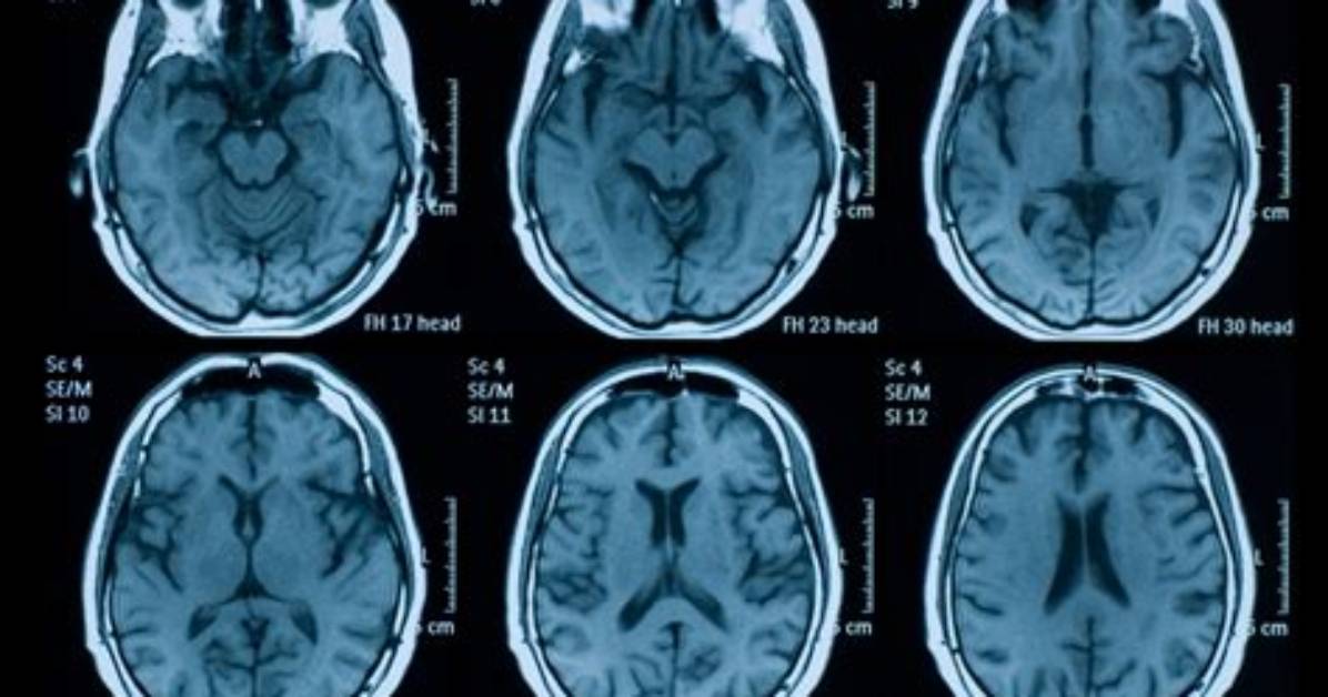 How Neuroimaging Can Yield Better Diagnostic Information