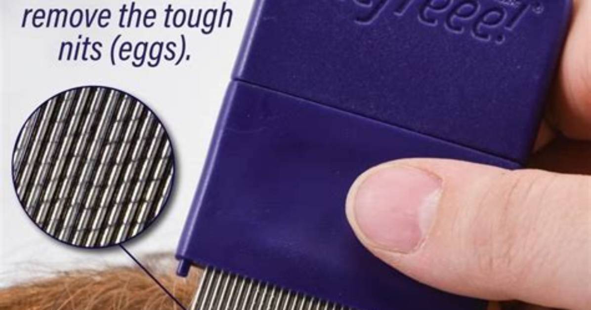 How Often Do You Comb out Nits?