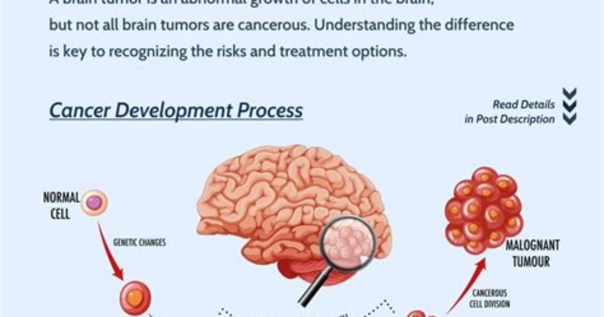 How Quickly Do Tumors Grow